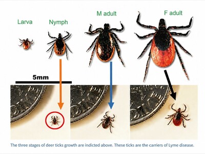 MINNEAPOLIMEDIA NEWS | Lyme Disease Remains a Growing Summer Threat Across Minnesota